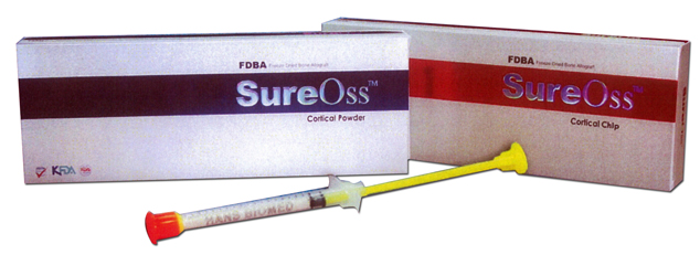 Костнозамещающий кортикальный порошок SureOss 1 см³ гранулы 0.2-0.8 мм. Hans Biomed